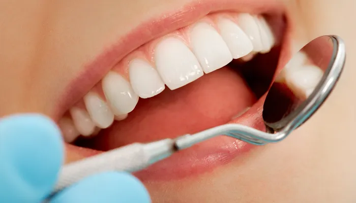 dental mirror looking into open mouth to perform a dental examination