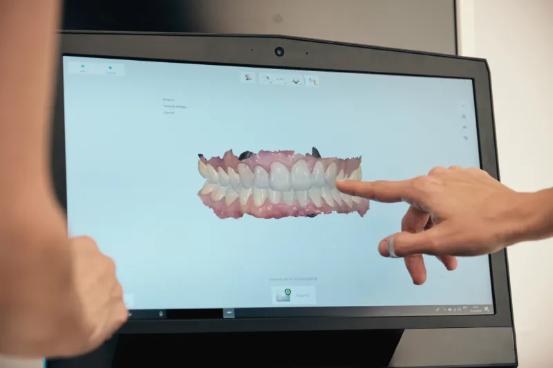 hand pointing to teeth scan on monitor