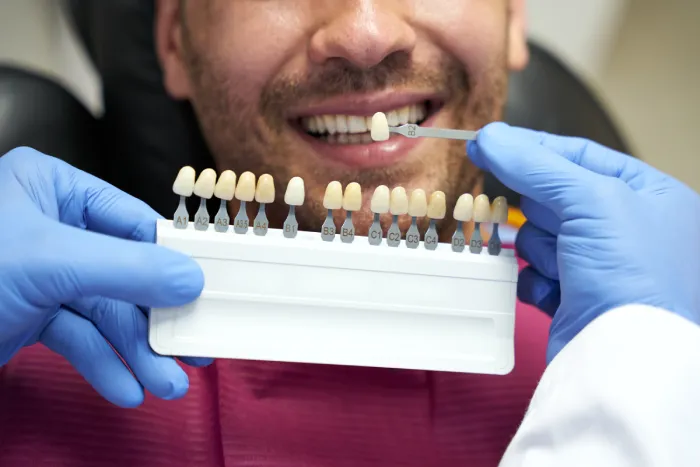 bearded man smiling while dental specialist picking proper shade of enamel