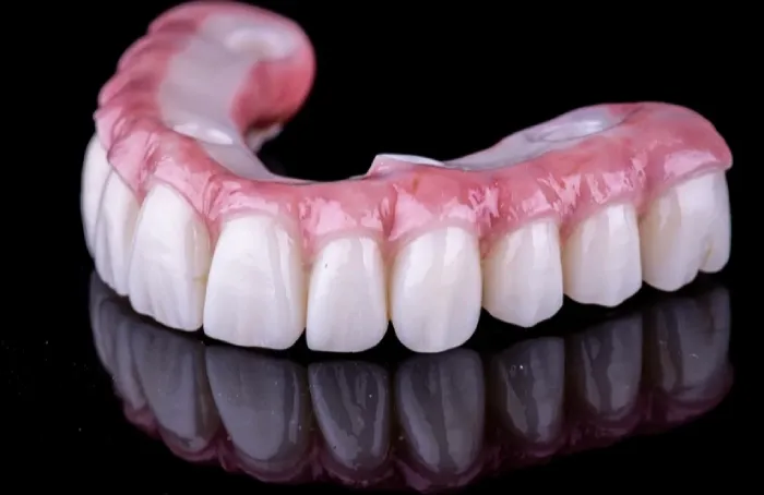 top teeth implants